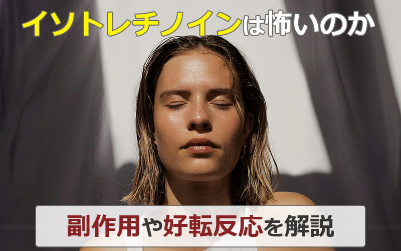 イソトレチノインは怖いのか｜副作用や好転反応を解説