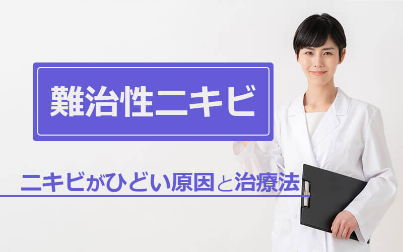 難治性ニキビ｜ニキビがひどい原因と治療法